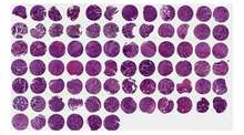 Bladder Tissue Microarray (TMA) Dot: 105 Case: 59 per slide