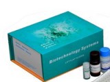 Human cutaneous T cell-attracting chemokine,CTACK ELISA Kit, 96T